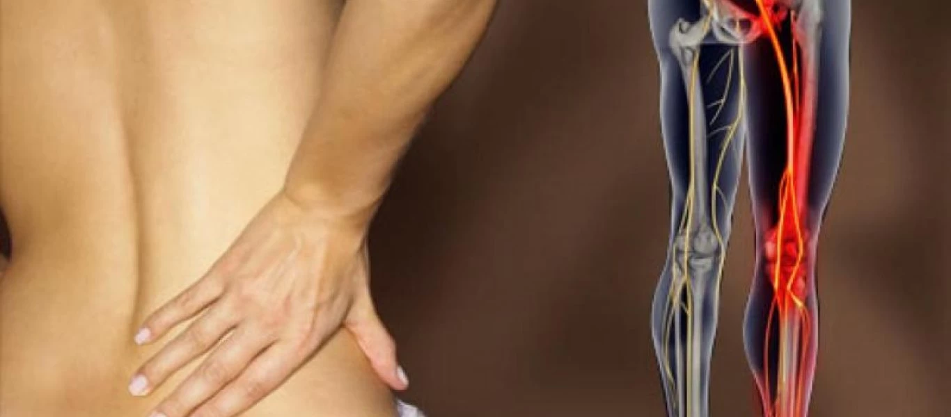 Ισχιαλγία: 8 πολύτιμες θεραπείες που θα σε ανακουφίσουν από τον πόνο